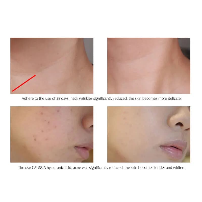 ArtiScare hyaluronic acid serum with vitamin C bottle — image 5