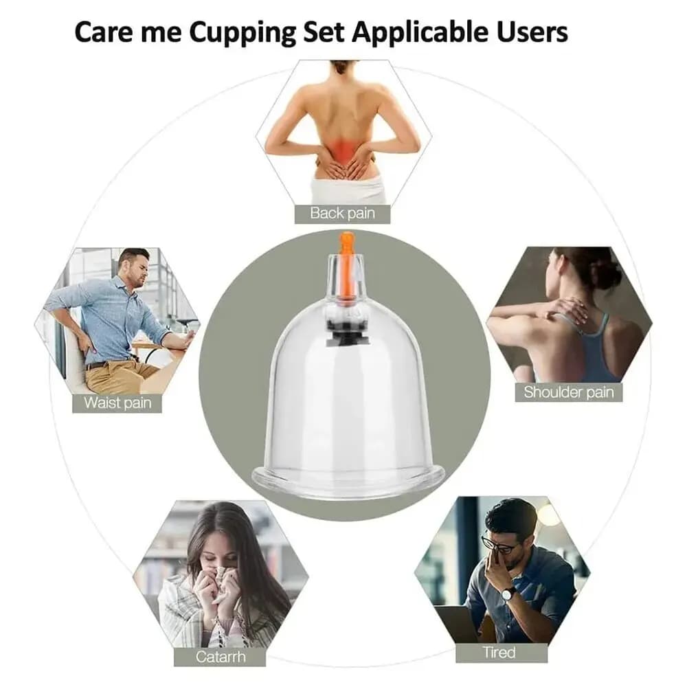 32-piece vacuum cupping massage set — image 6
