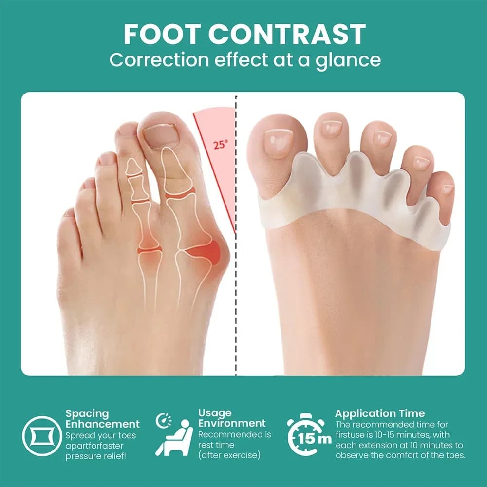 pair of silicone toe separators for bunion and hammer toe — image 3