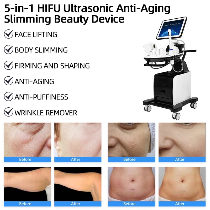 5 Handles Skin Tightening Hifu Machine Skin Rejuvenation Wrinkle — image 5