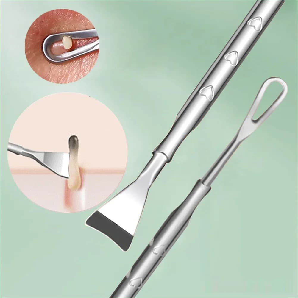 handheld blackhead remover tool with stainless steel tip — image 3