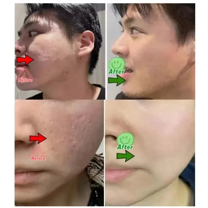 pore shrinking cream tube — image 3