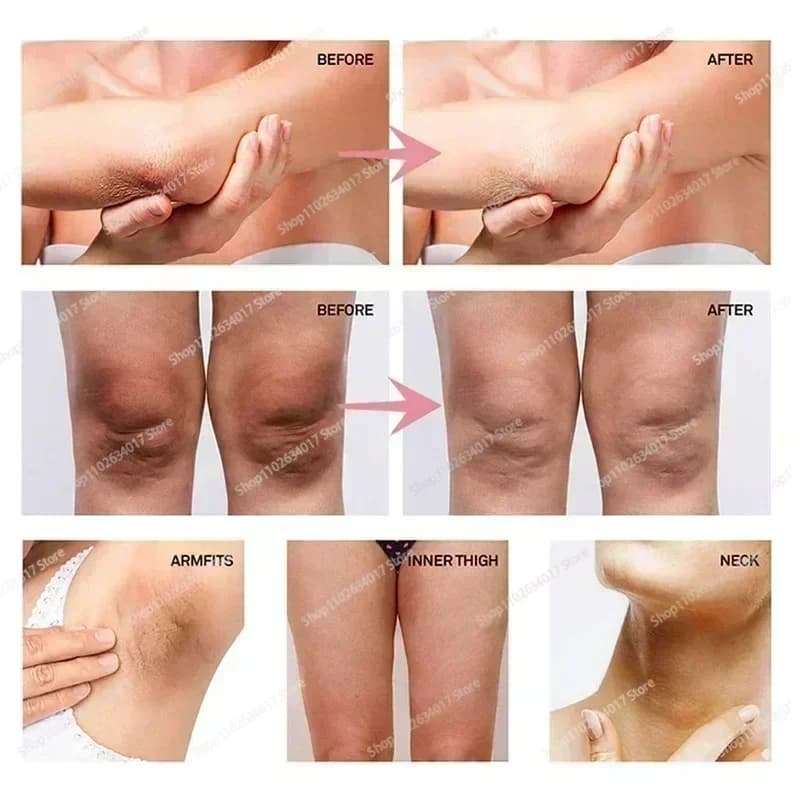 Whitening cream tube for underarms and intimate areas — image 2