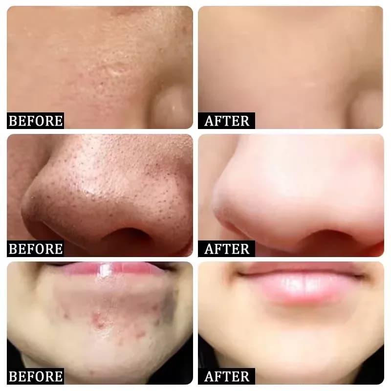 pore shrinking cream tube — image 2
