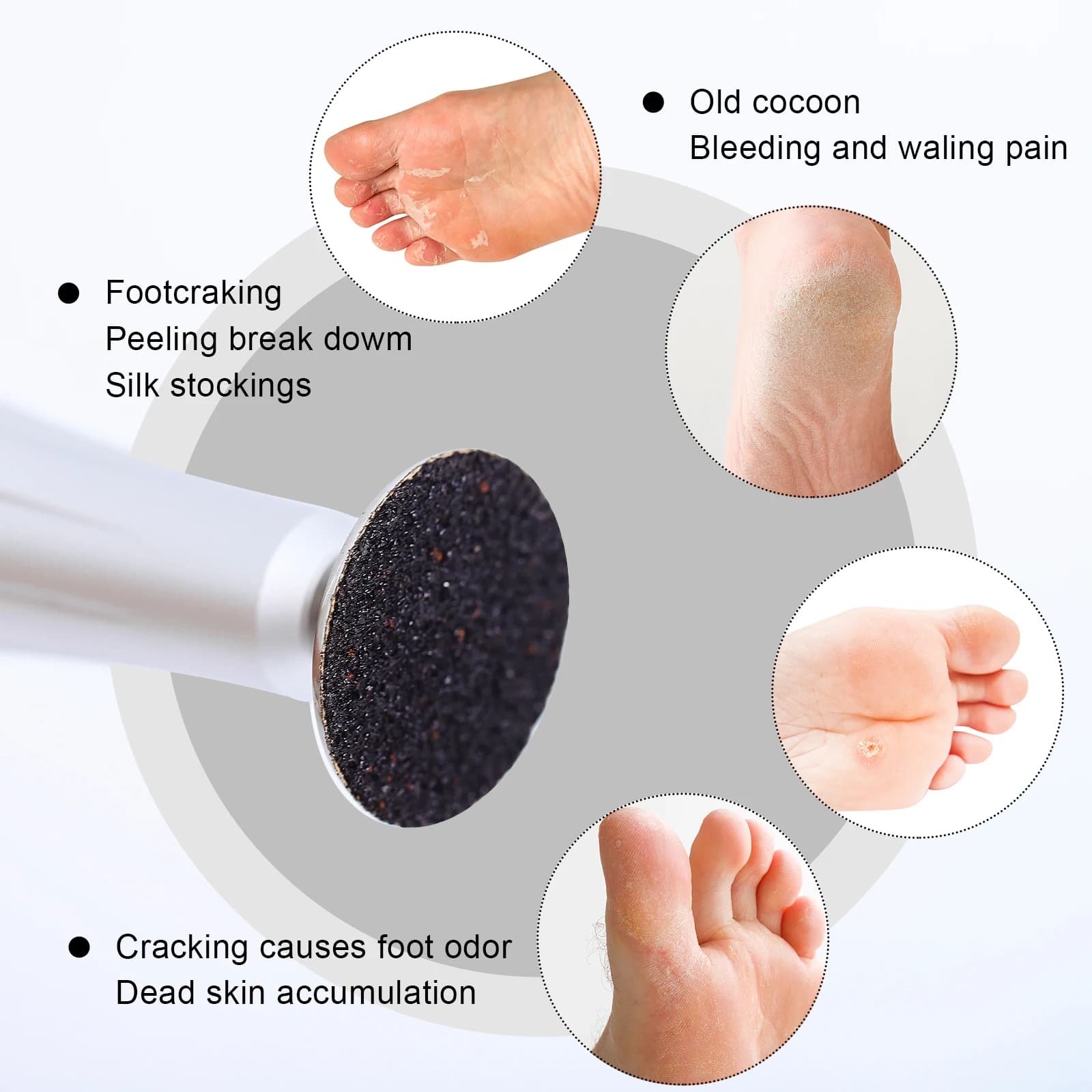 Foot callus remover disc with replaceable sandpaper — image 6