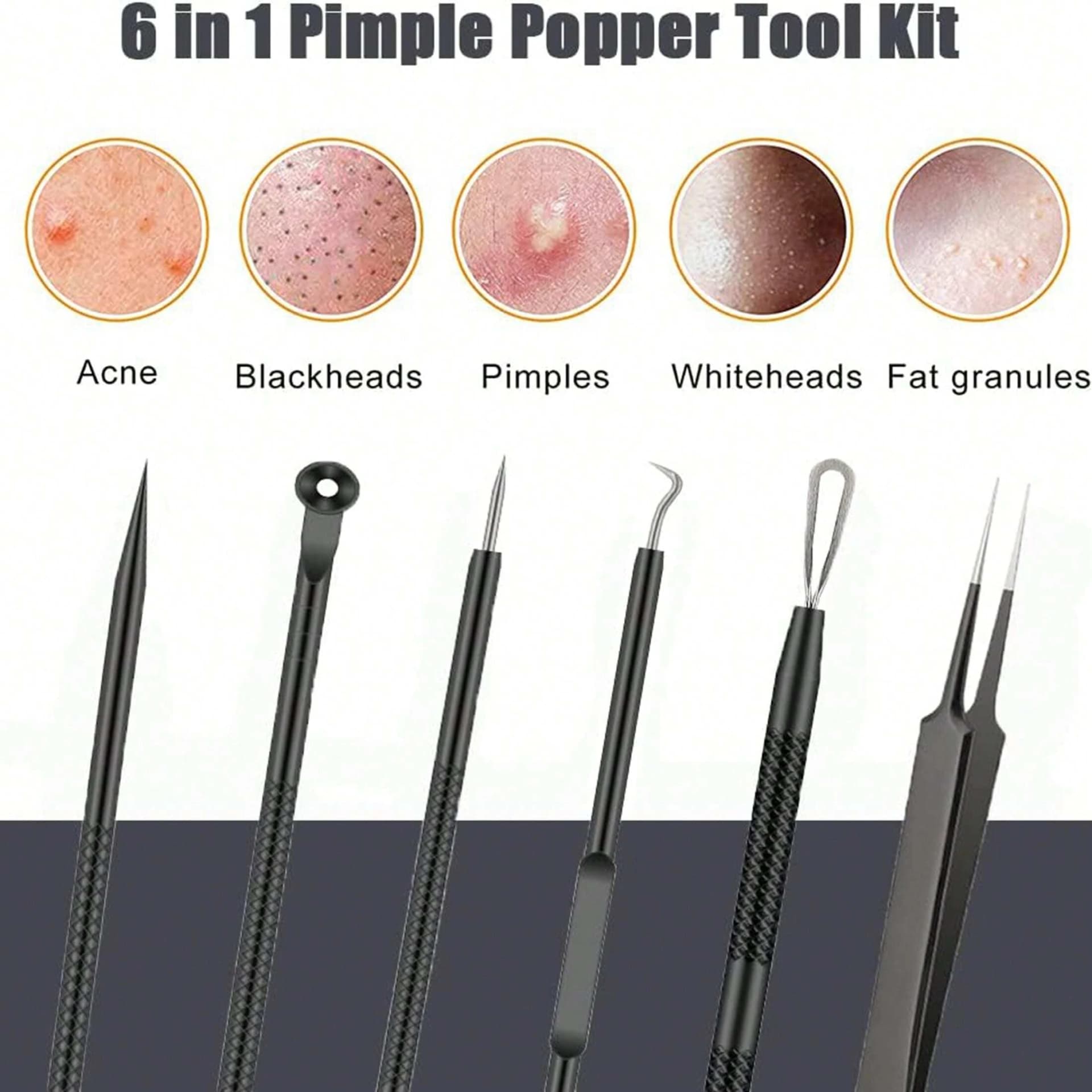 stainless steel 6-piece acne tool set with blackhead extractor — image 4