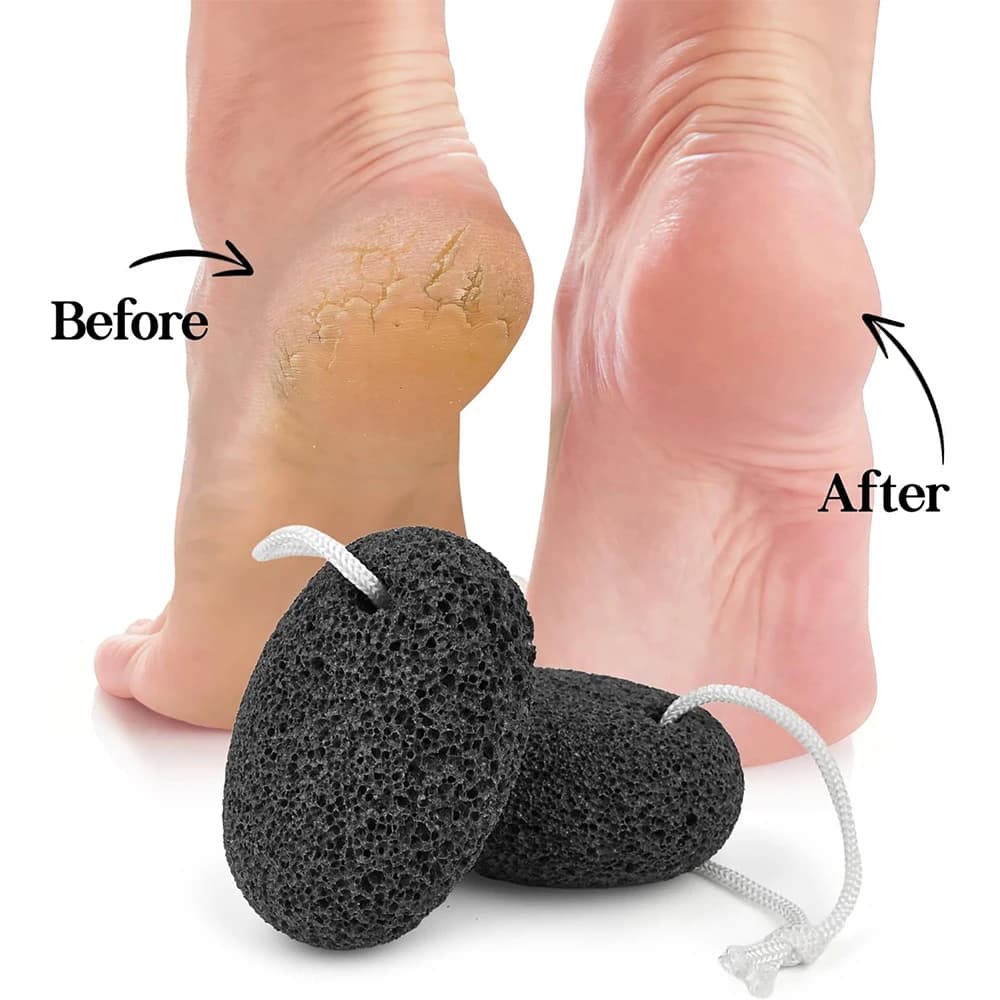 Lava pumice stone for removing foot and hand calluses — image 4