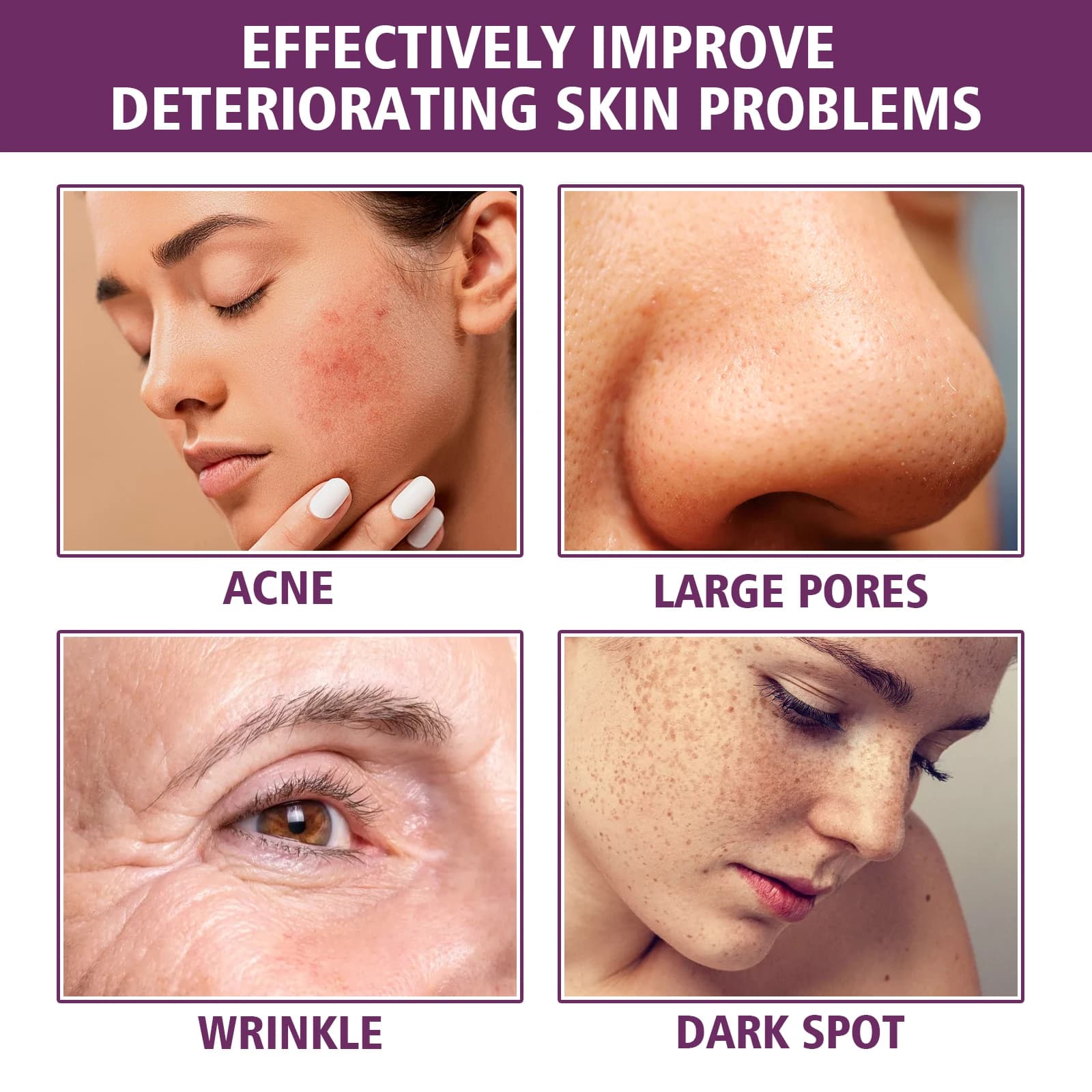 20% niacinamide serum bottle — image 5
