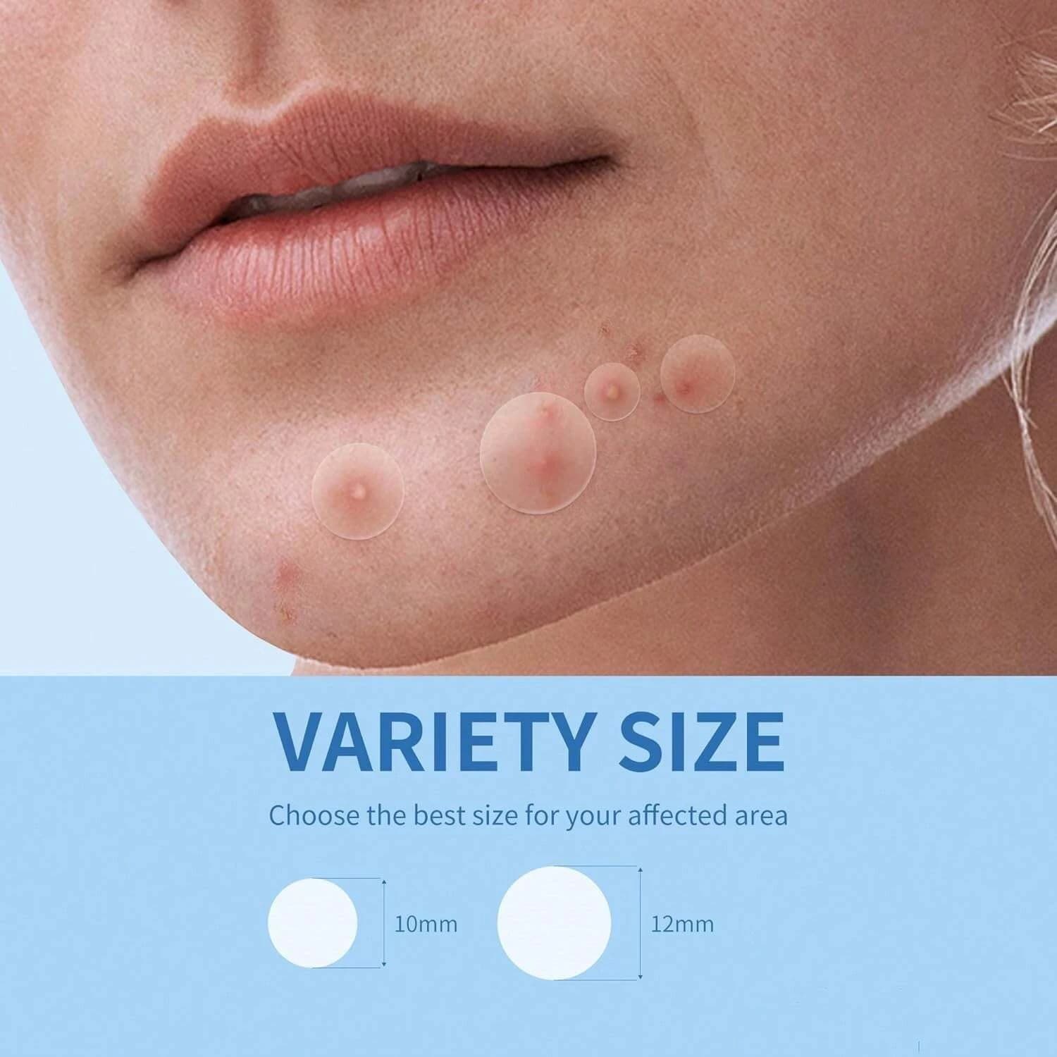transparent waterproof hydrocolloid acne patch — image 4