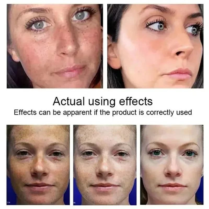 Kojic acid whitening essence bottle — image 4