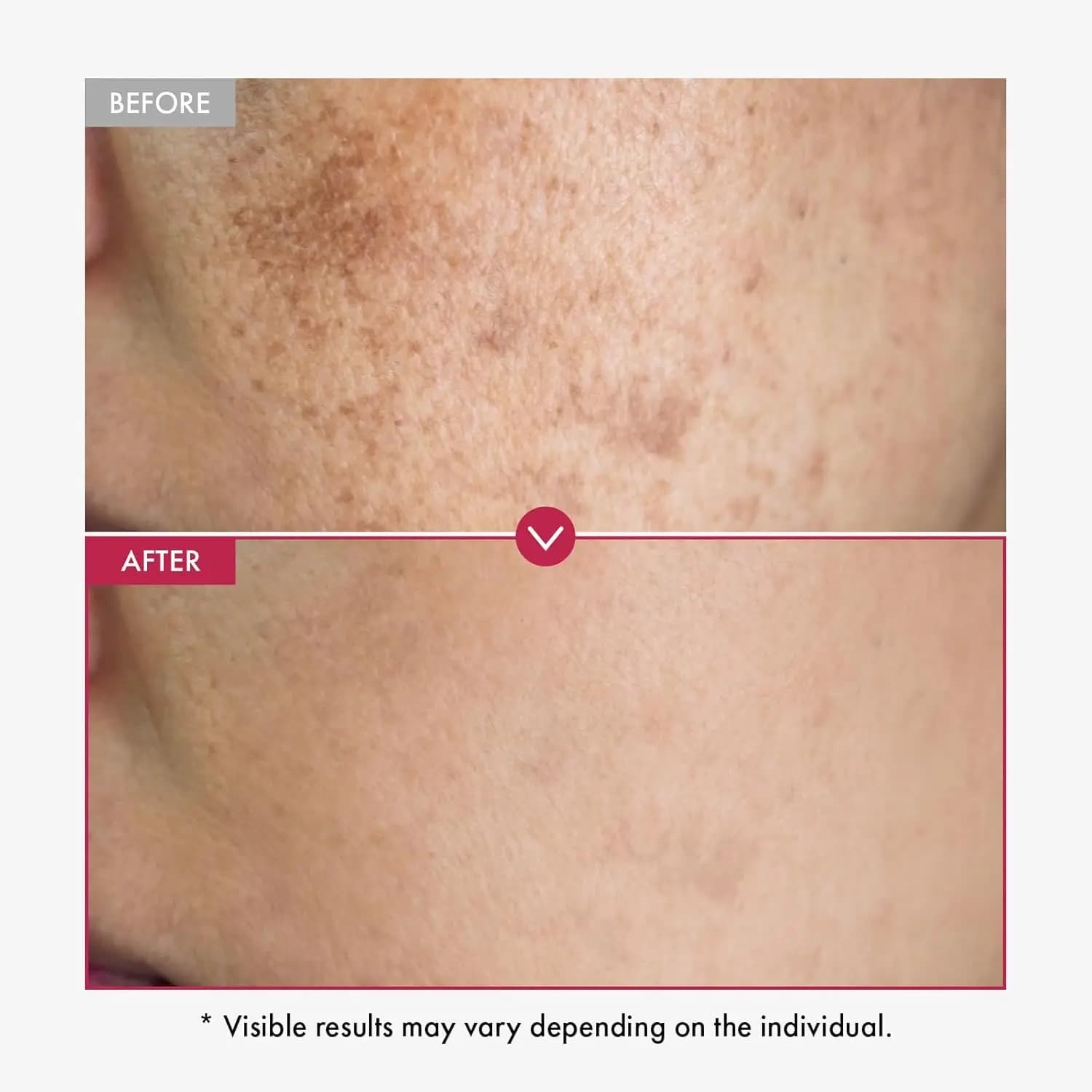 Alpha arbutin and AHA brightening serum bottle — image 3