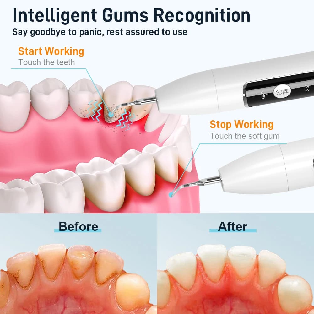 handheld ultrasonic dental scaler — image 6