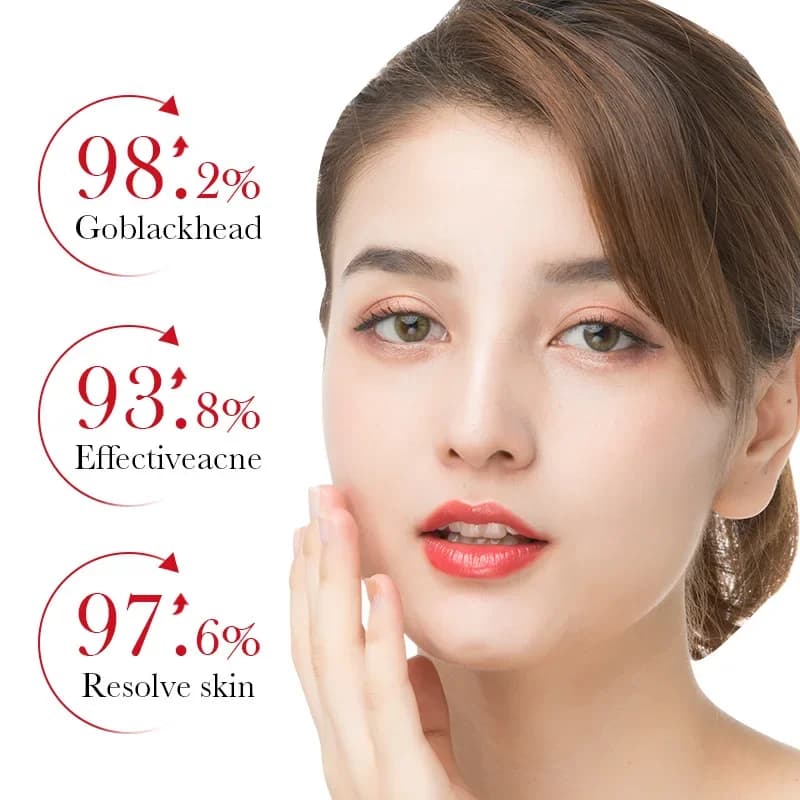 salicylic acid acne removing essence serum — image 3