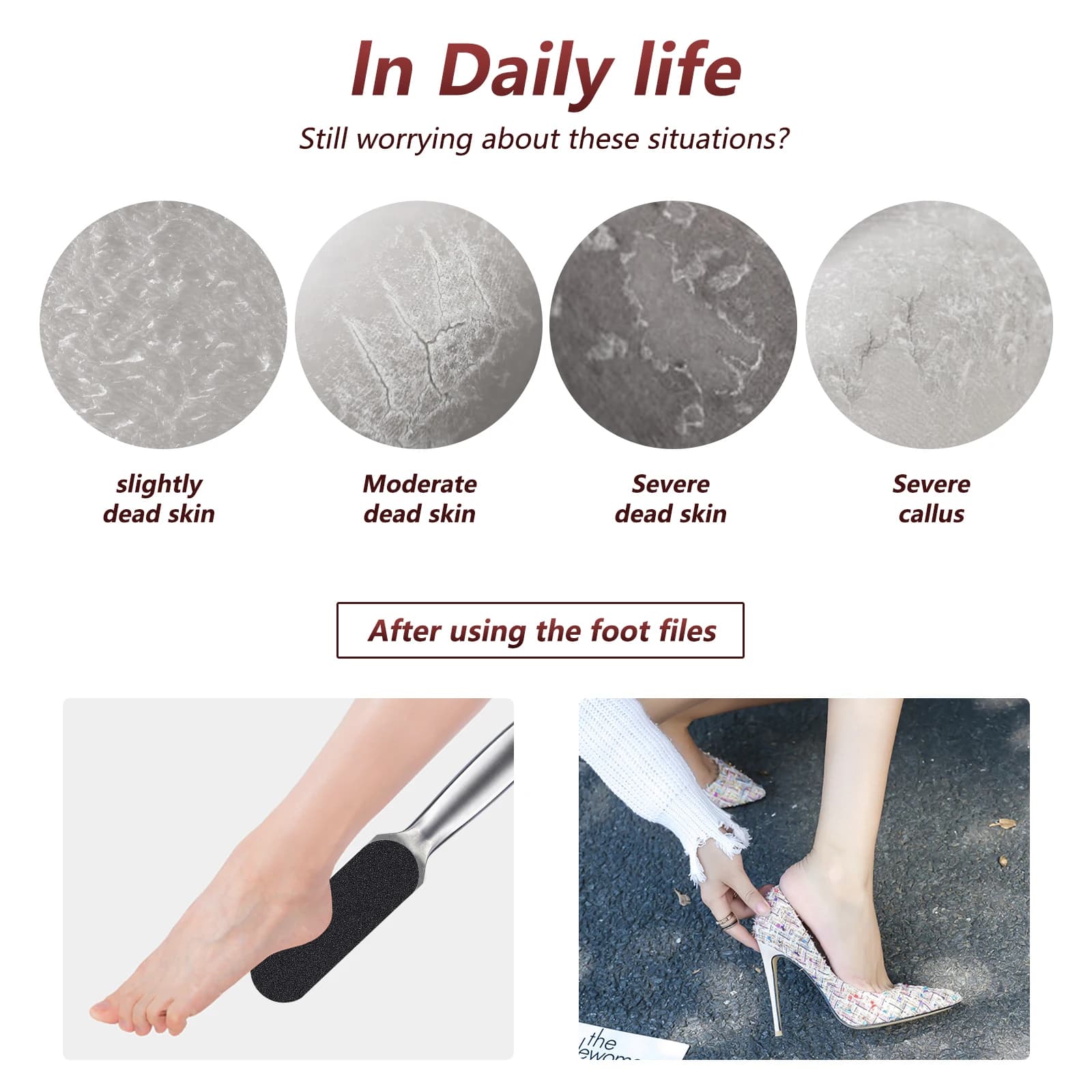 Stainless steel foot rasp with 20 interchangeable files — image 4