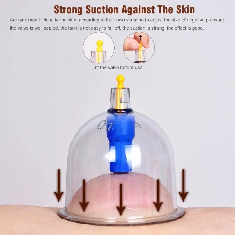 32-piece vacuum cupping massage set — image 3