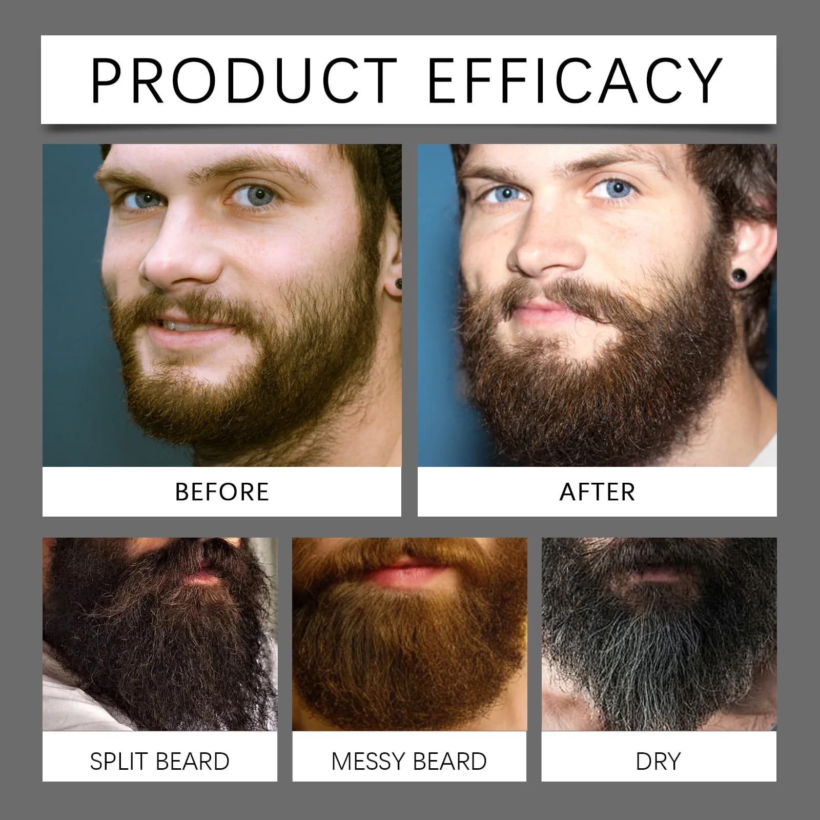 beard growth serum set — image 4
