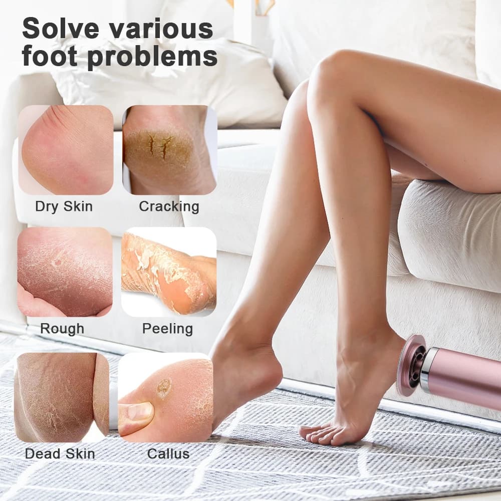 Rechargeable wireless foot callus remover device — image 6