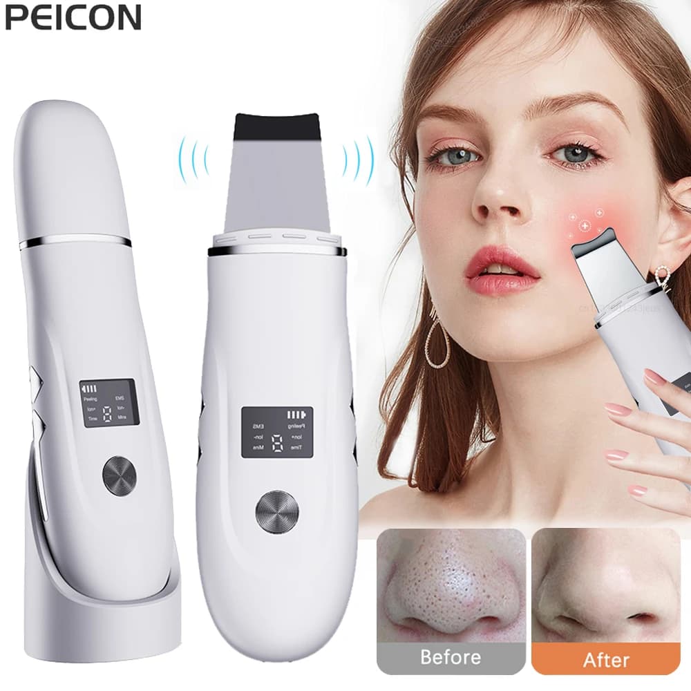 Ultrasonic Facial Scrubber