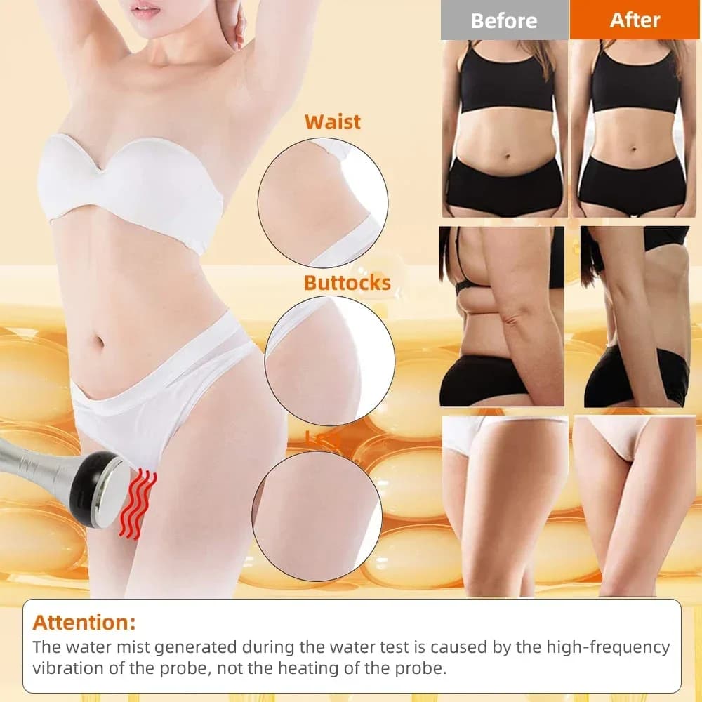 4-in-1 cavitation body slimming machine with vacuum suction — image 4