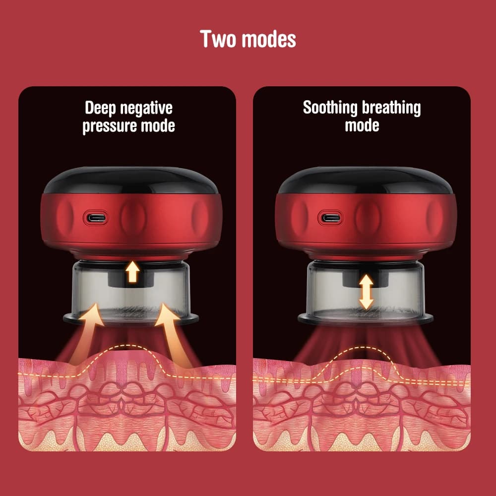wireless electric cupping massager — image 3