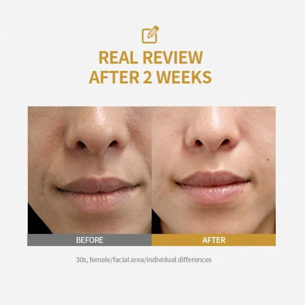 peptide intensive lifting ampoule bottle — image 4
