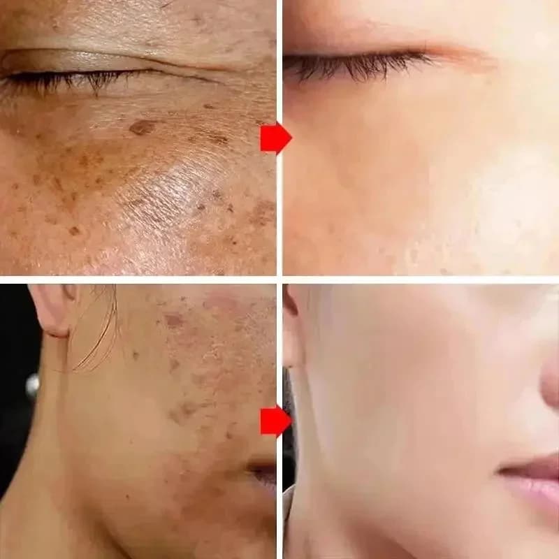 Spot-removing brightening cream tube — image 3