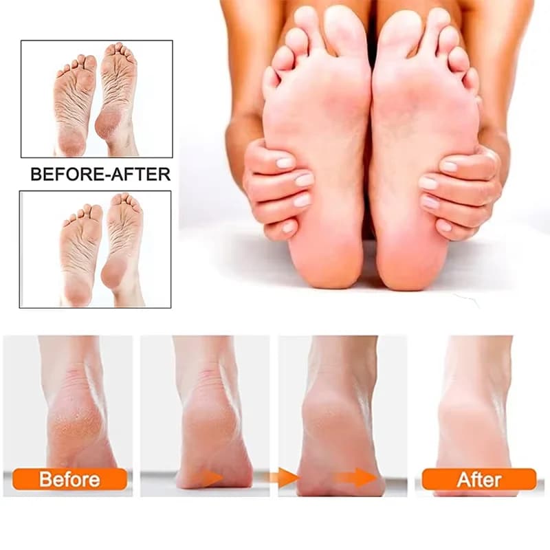 Rechargeable electric foot file with ten interchangeable heads — image 5