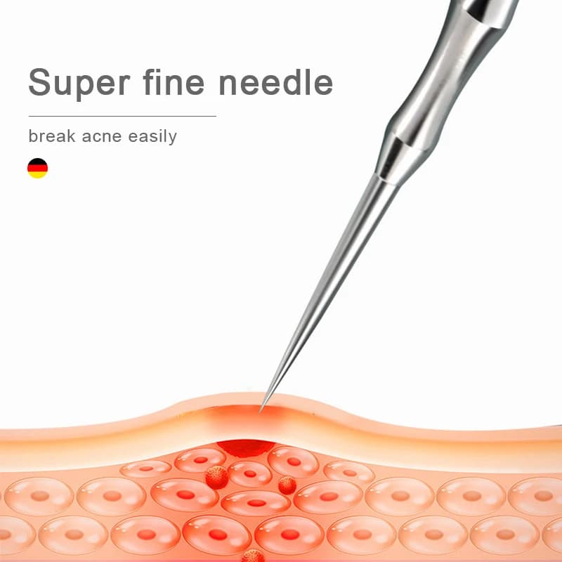 German acne and blackhead removal needle clip — image 3