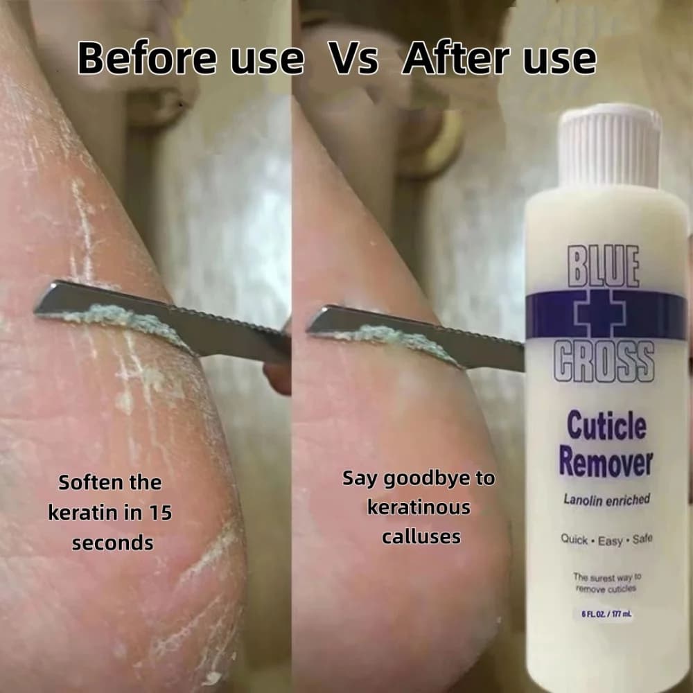 Foot cuticle remover and exfoliating foot mask in a 177 ml bottle — image 5