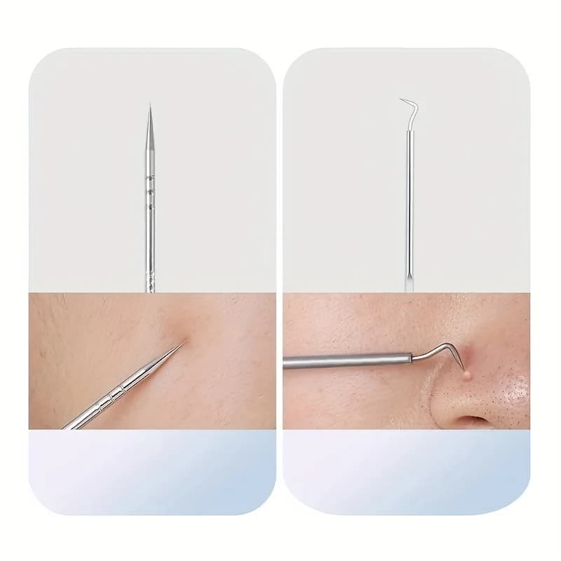 Stainless steel acne removal tool set with multiple extractor heads — image 5