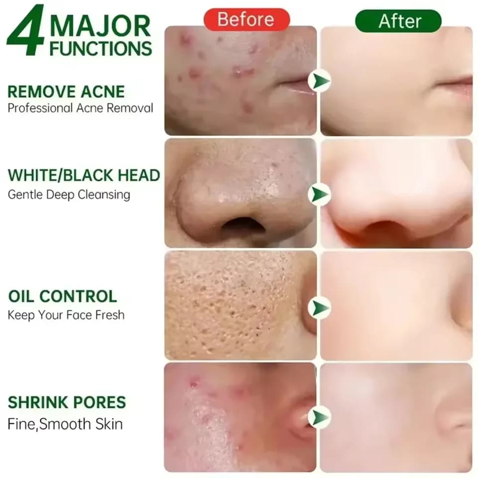 pore shrinking cream tube — image 4