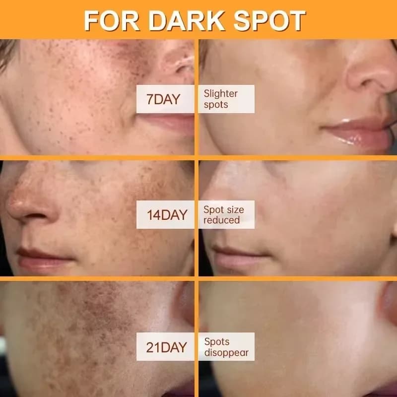 whitening face cream jar — image 2