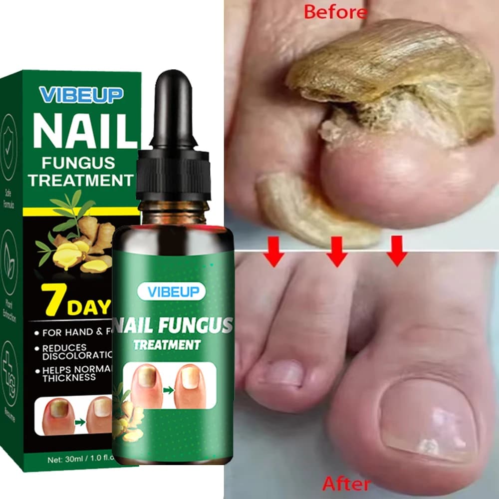 Fungal nail treatment serum bottle — image 1
