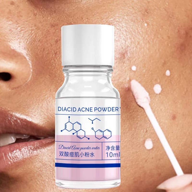 pink acne essence bottle 10ml — image 1