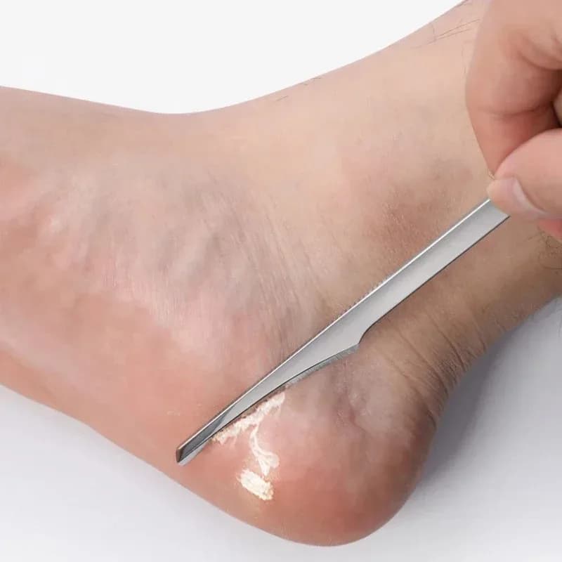 Toe nail shaver and callus file kit — image 8
