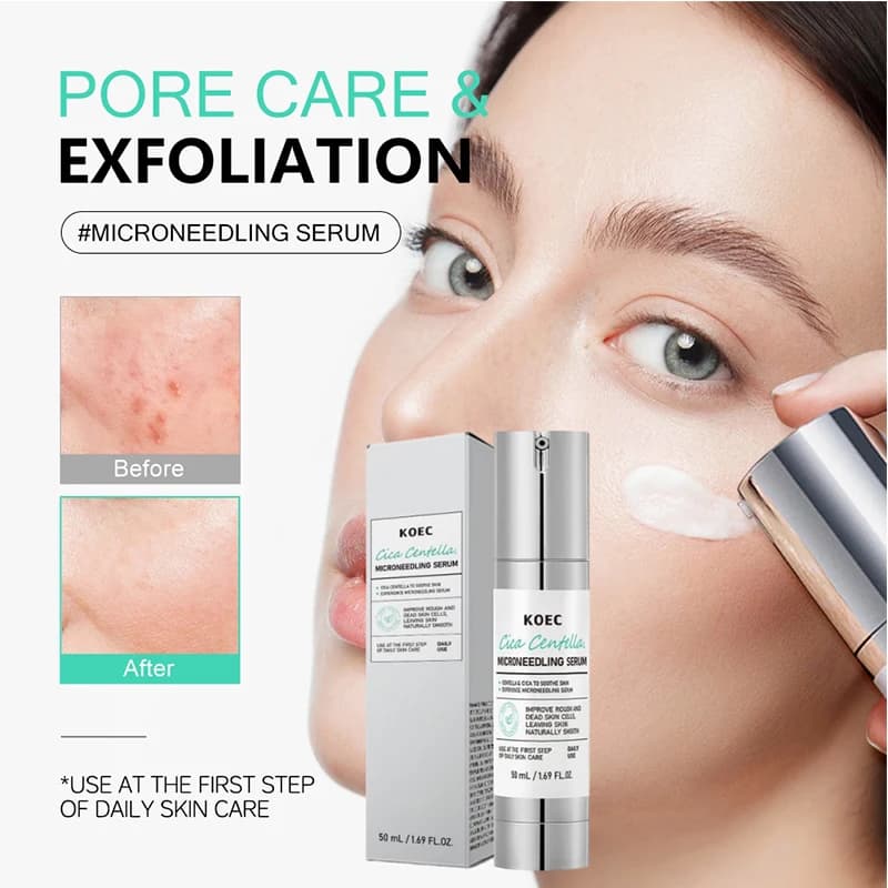 microneedle essence bottle 50ml — image 2