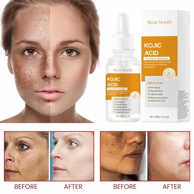 Kojic acid whitening essence bottle — image 3