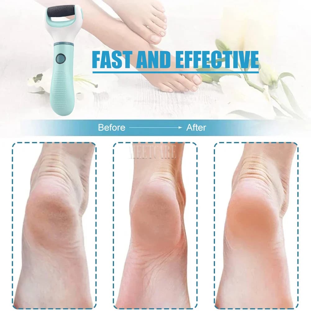 electric foot grinder for callus removal — image 4