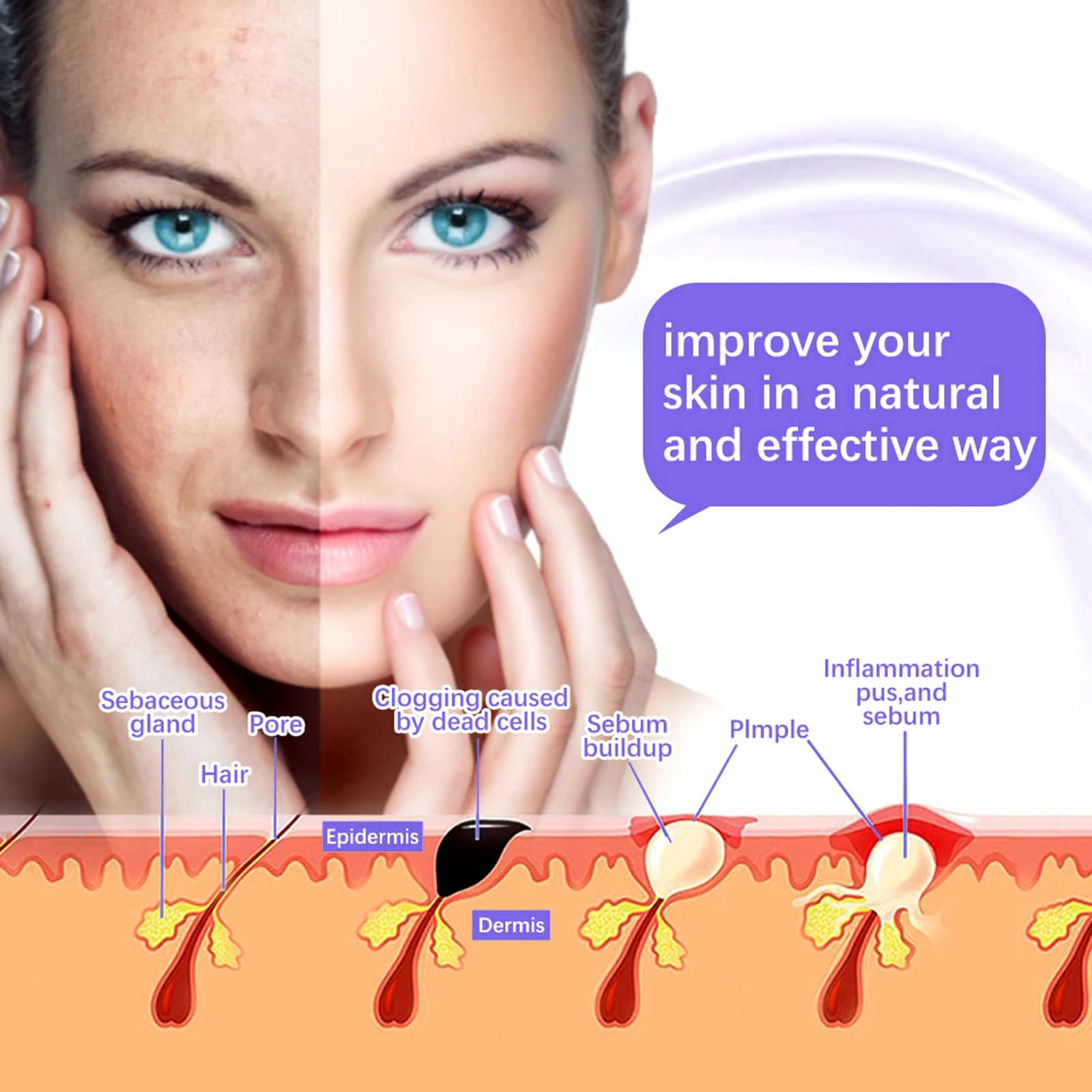 high frequency facial electrotherapy wand with glass electrode — image 3