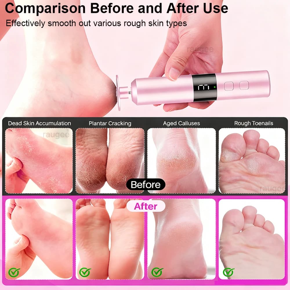 rechargeable electric foot callus grinder — image 6
