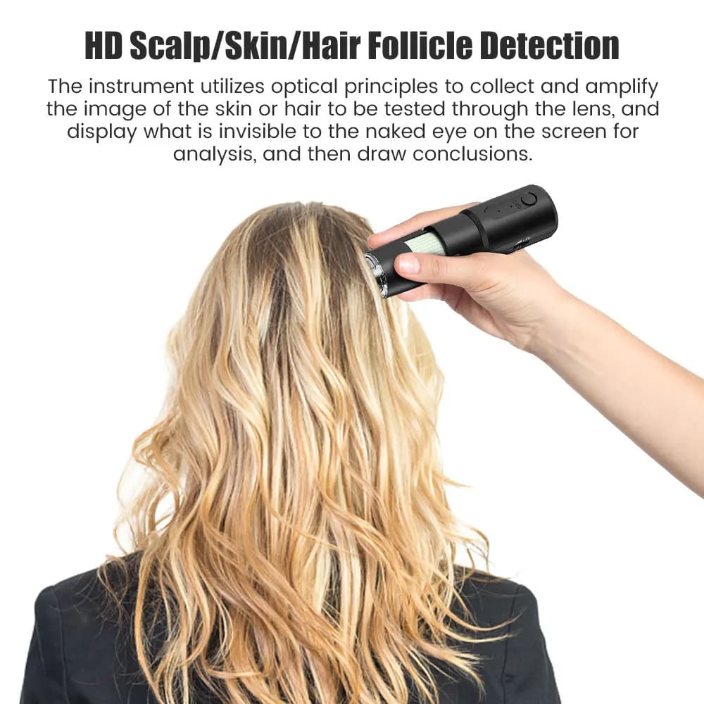 handheld wireless dermatoscope for scalp and skin analysis — image 4