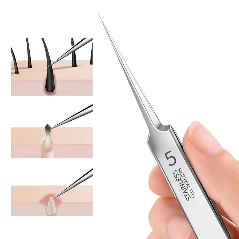extra fine #5 acne and blackhead removal tweezers — image 2