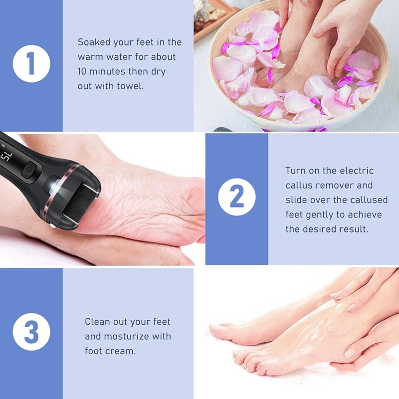 electric foot file for callus removal — image 6