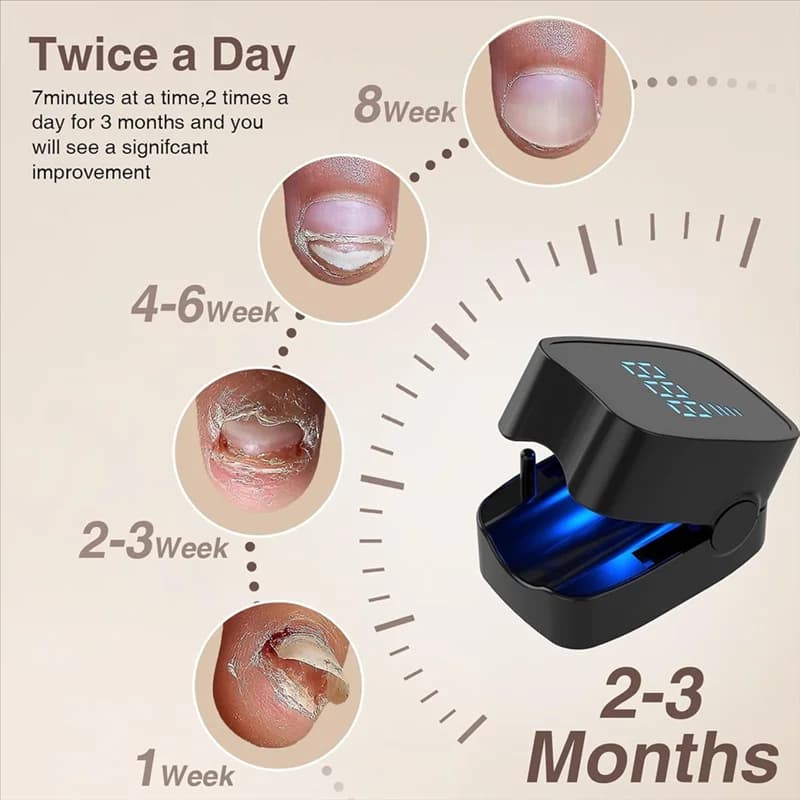 handheld infrared and blue LED nail fungus treatment device — image 5