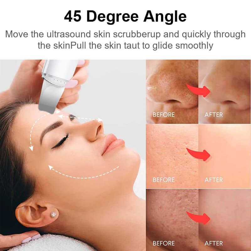 ultrasonic skin scrubber device — image 6