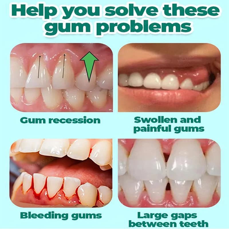 60ml gum repair gel serum — image 4