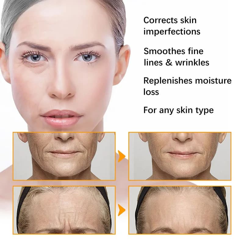 turmeric acne cream jar — image 4