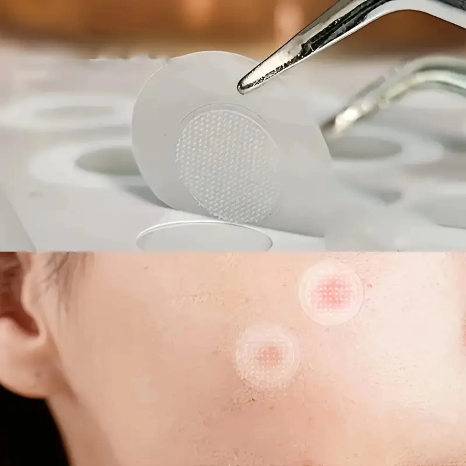 hydrocolloid acne stickers pack of 24 — image 6