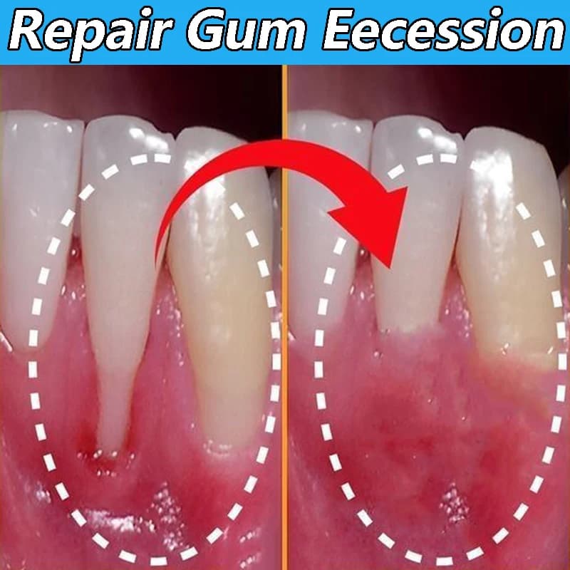 60ml gum repair gel serum — image 2