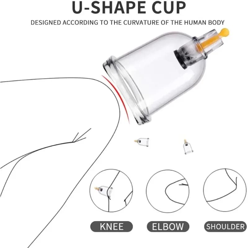 vacuum cupping therapy set with suction cups — image 4
